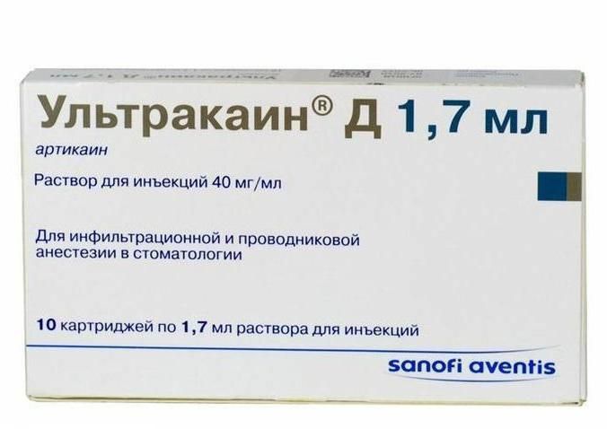 Ультракаин Д, 40 мг/мл, раствор для инъекций, 1.7 мл, 10 шт.
